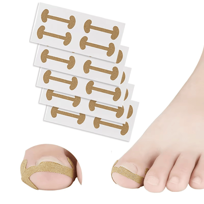 Nageltrångsplåster som avlastar trycket runt en inåtväxande tånagel