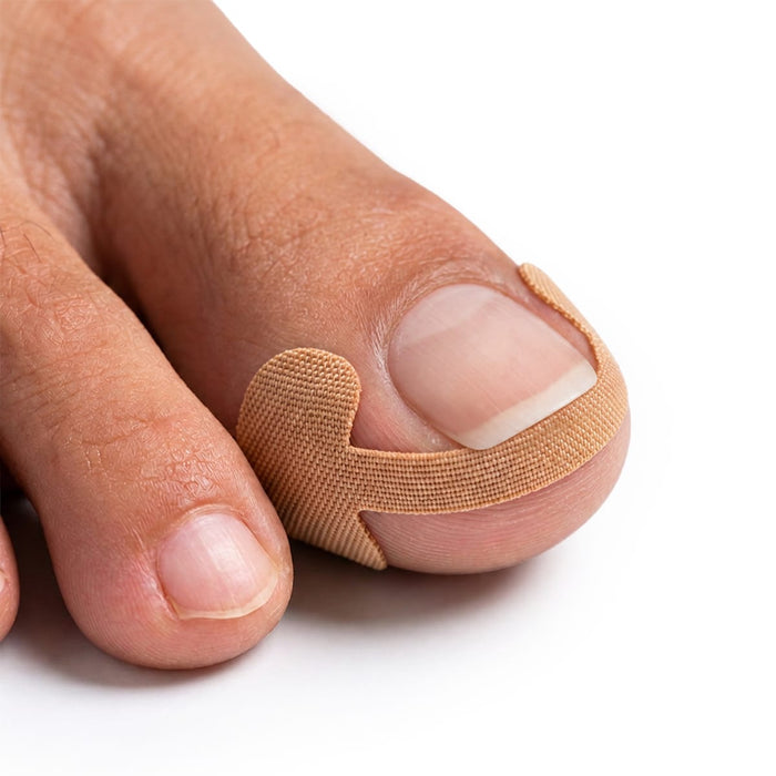 Nageltrångsplåster (12st)