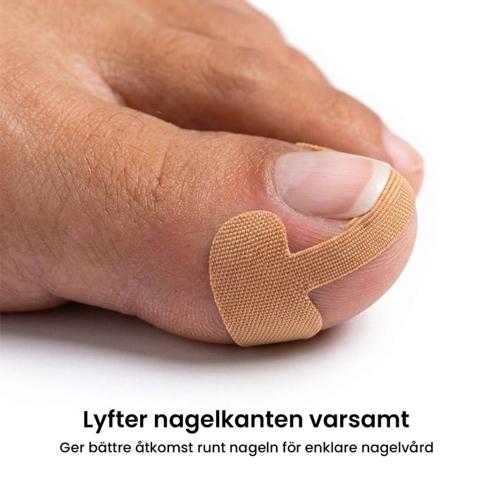 Nageltrångsplåster (12st)