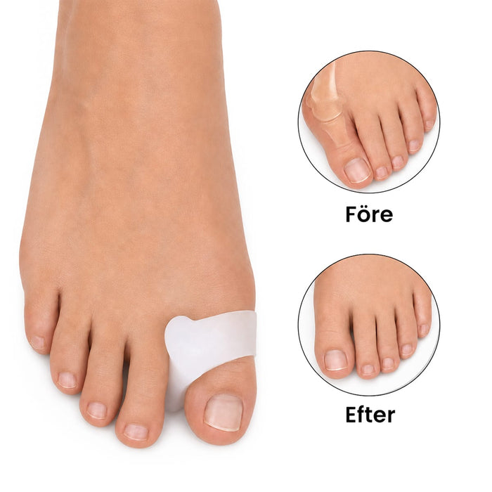 Hallux Valgus tåutjämnare
