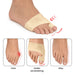 Foto med gelstrumpa för hallux valgus; bilderna visar korrigering av sned stortå före, under och efter användning.