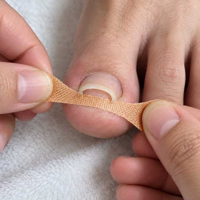 Nageltrångsplåster (12st)