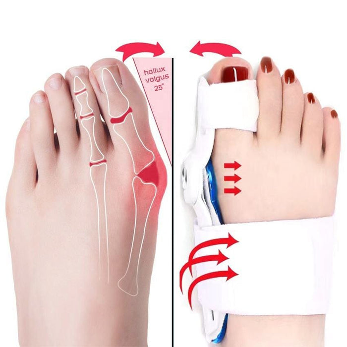 Kroppsbutiken Bunion Bunion korrigerare