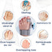 Kroppsbutiken Bunion Hallux valgus korrektor justerbar