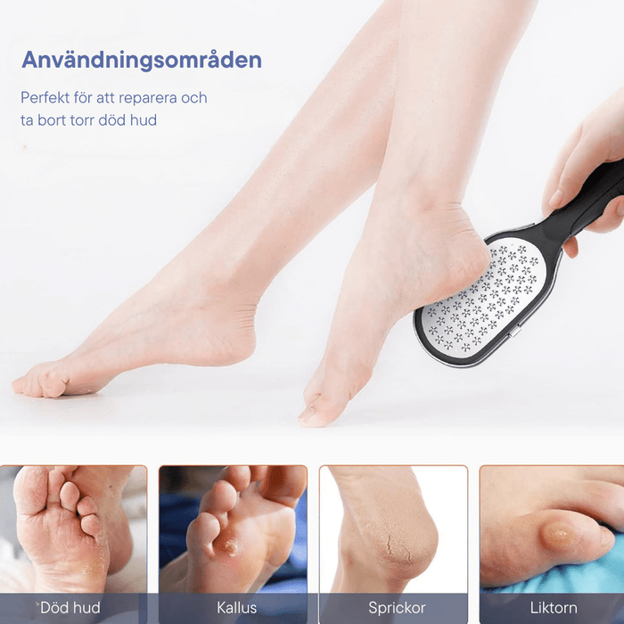 Kroppsbutiken Fotfil Rostfri fotfil för callus