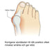 Kroppsbutiken Hallux Valgus Hallux valgus silikonskydd