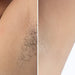 Kroppsbutiken IPL Pro Laser Hårborttagare