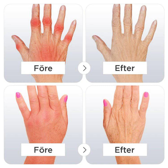 Kroppsbutiken Kompressionshandskar Kompressionshandskar för Artit