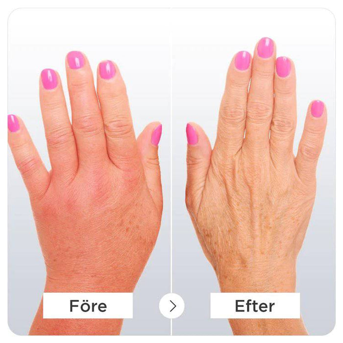 Kroppsbutiken Kompressionshandskar Kompressionshandskar för Artit