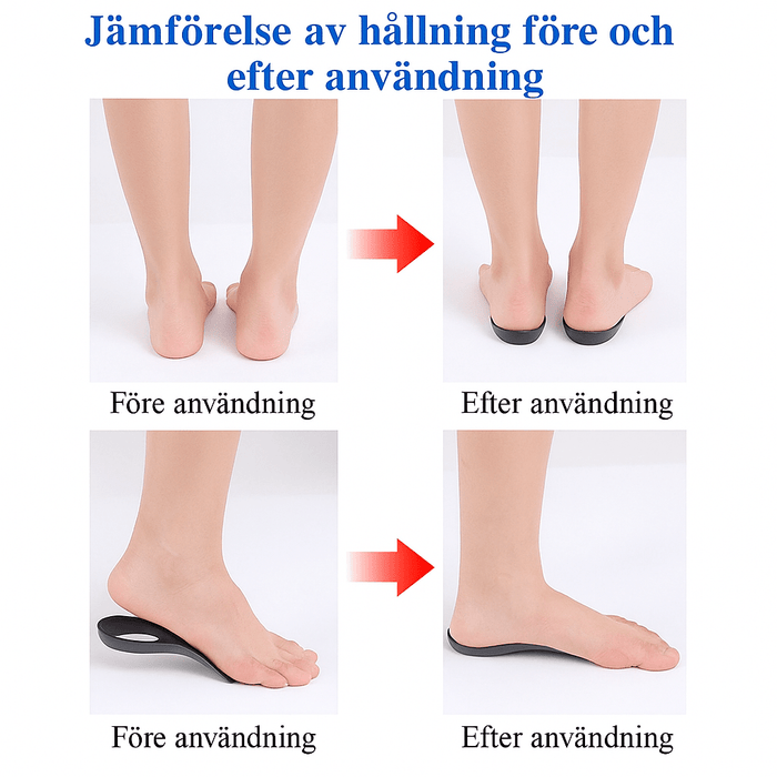 Kroppsbutiken Plattfotsstöd skoinlägg